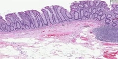 Colon Histology