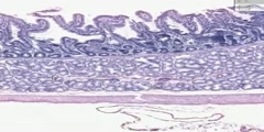 Gastroduodenal junction histology