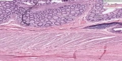 Rectoanal junction histology