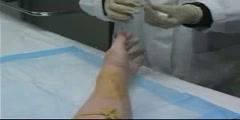 Video of peripheral venous access technique