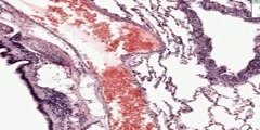 Lung Histology