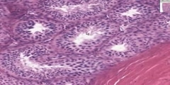 Histology of Testis