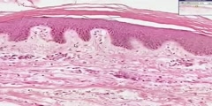 Histology of Thin Skin