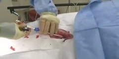 Pulmonary artery catheter and central venous catheter placement CVP