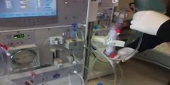 Hemodialysis Machine Setup Watch Video