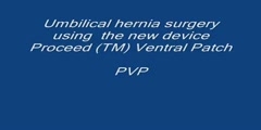 Umbilical hernia video of  painless surgical repair