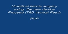 Umbilical hernia video of  painless surgical repair