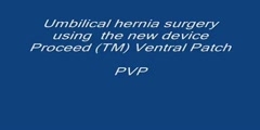 Umbilical hernia surgery