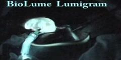 Lumigram hepls diagonsis of gallbladder problems