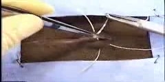 How to do a vertical mattress pattern suture