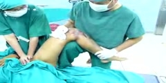 Fixing a Hip Dislocation