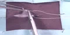 Subcuticular Pattern Continuous Suture Techniques