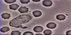 White Blood Cells Vs Bacteria