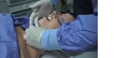 Needle cricothyroidotomy