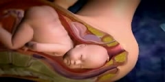 Foreceps Delivery Birth  - Scientific Video and Animation Site