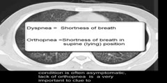 Chest CT scan chest