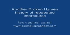 Hymenoplasty Hymen Repair Surgery in India