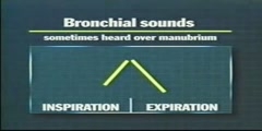 Different Types of Breath Sounds