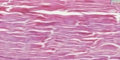 Dense Regular Connective Tissue Histology