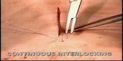 Interlocking Continuous Suture Procedure