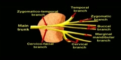 Saving The Facial Nerve During Parotid Gland Surgery