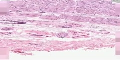 histology of gastroesophageal junction fetal pediatric autopsy