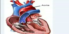 A Chest X-Ray Showing Artificial Aortic And Mitral Valves