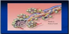 Pulmonary embolism  diagnosis