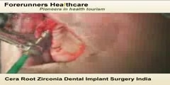 Cera Root Zirconia Dental Implant