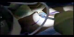 Plastic Surgery, A Breast Augmentation Video
