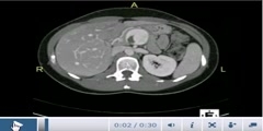 Structure of Abdomen on CT Scan