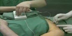 Catheter Brachial Plexus Block Procedure