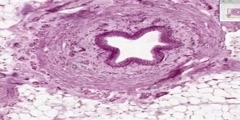 Histology of ureter