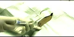 Lateral internal sphincterotomy treatment  - Scientific Video  and Animation Site