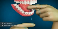 Dental Flossing