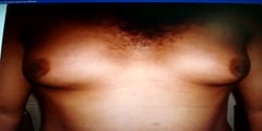 FILM OF GYNECOMASTIA IN QATAR