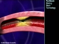 DHLI-PACLITAXEL EFFECTS