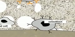 Generation of osteoclastic bone metastases